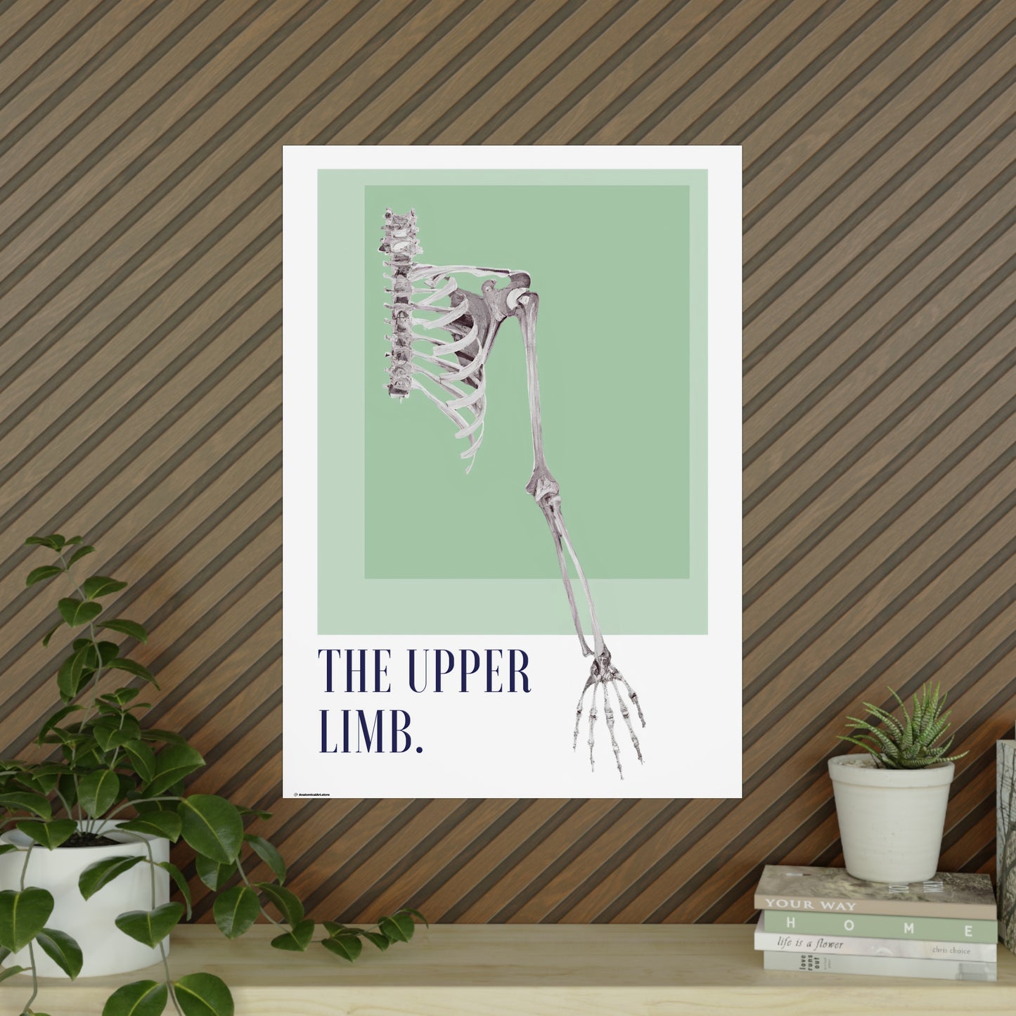 The Upper Limb Poster